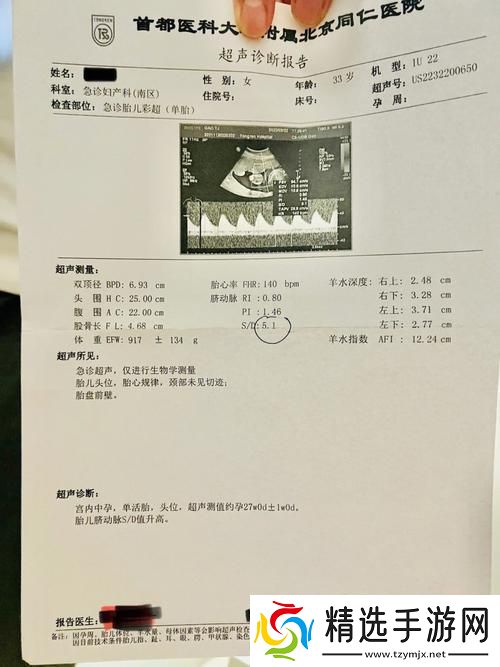 “OVO食肉族报告4”